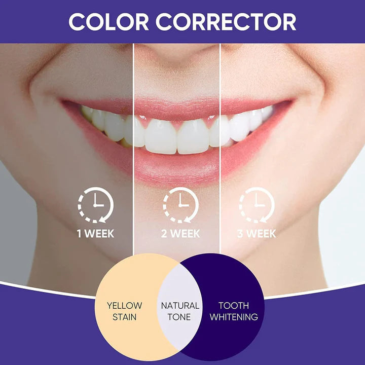 SmileKit™ V34 Teeth Whitener