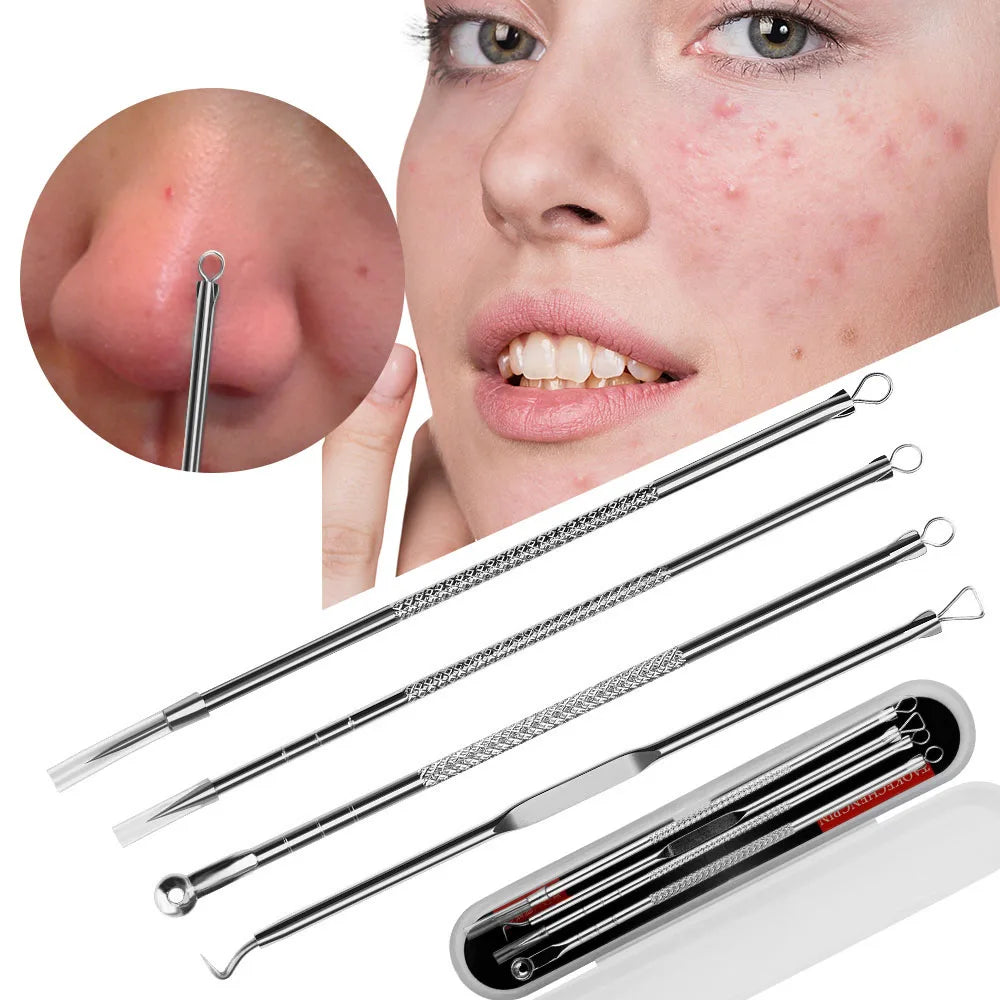 FaceIT™ Blackhead Removal Tweezers &amp; Acne Extractor KIT